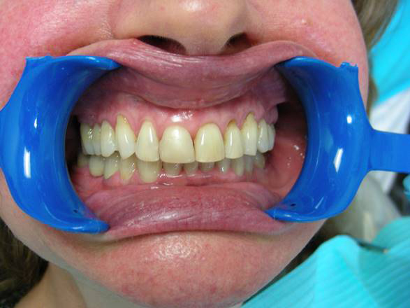 Family Dentist in Elizabeth