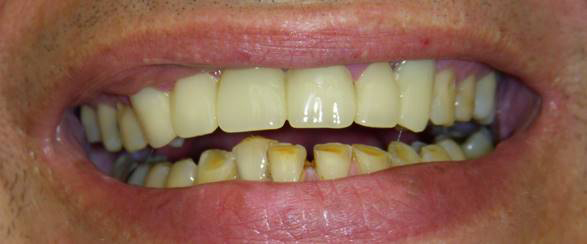 Dental Office in Roselle