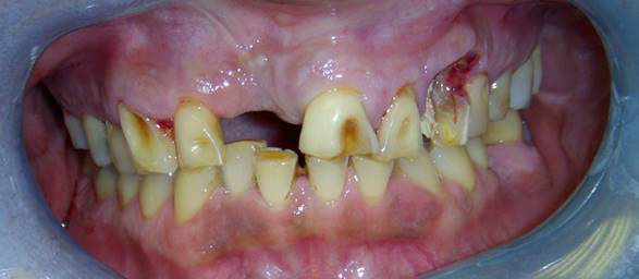 Family Dentist in Elizabeth