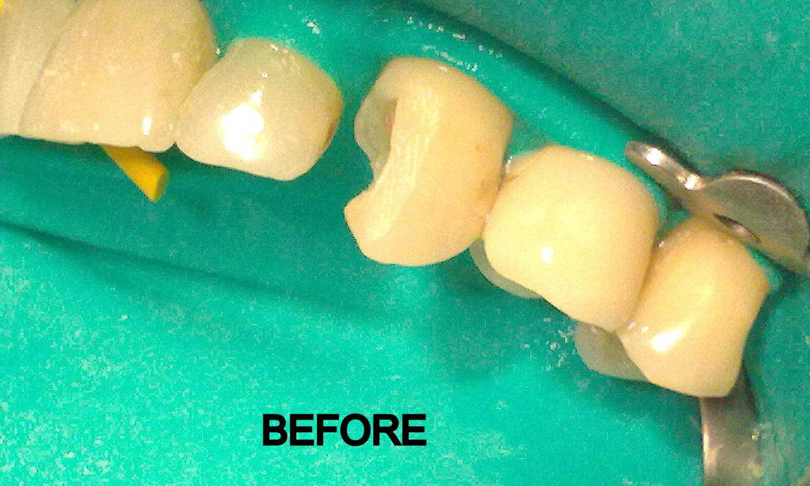 Dentistry Before and After Photos | Urban Smiles Dental