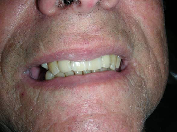 Family Dentist in Roselle