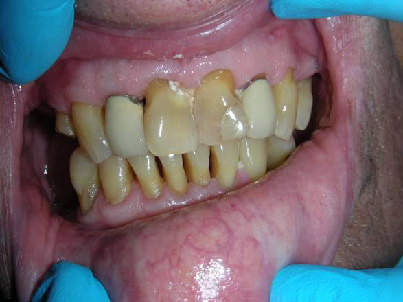 Family Dentist in Elizabeth