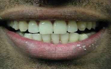 Dental Office in Roselle