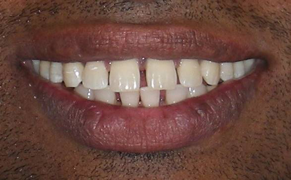 Family Dentist in Elizabeth