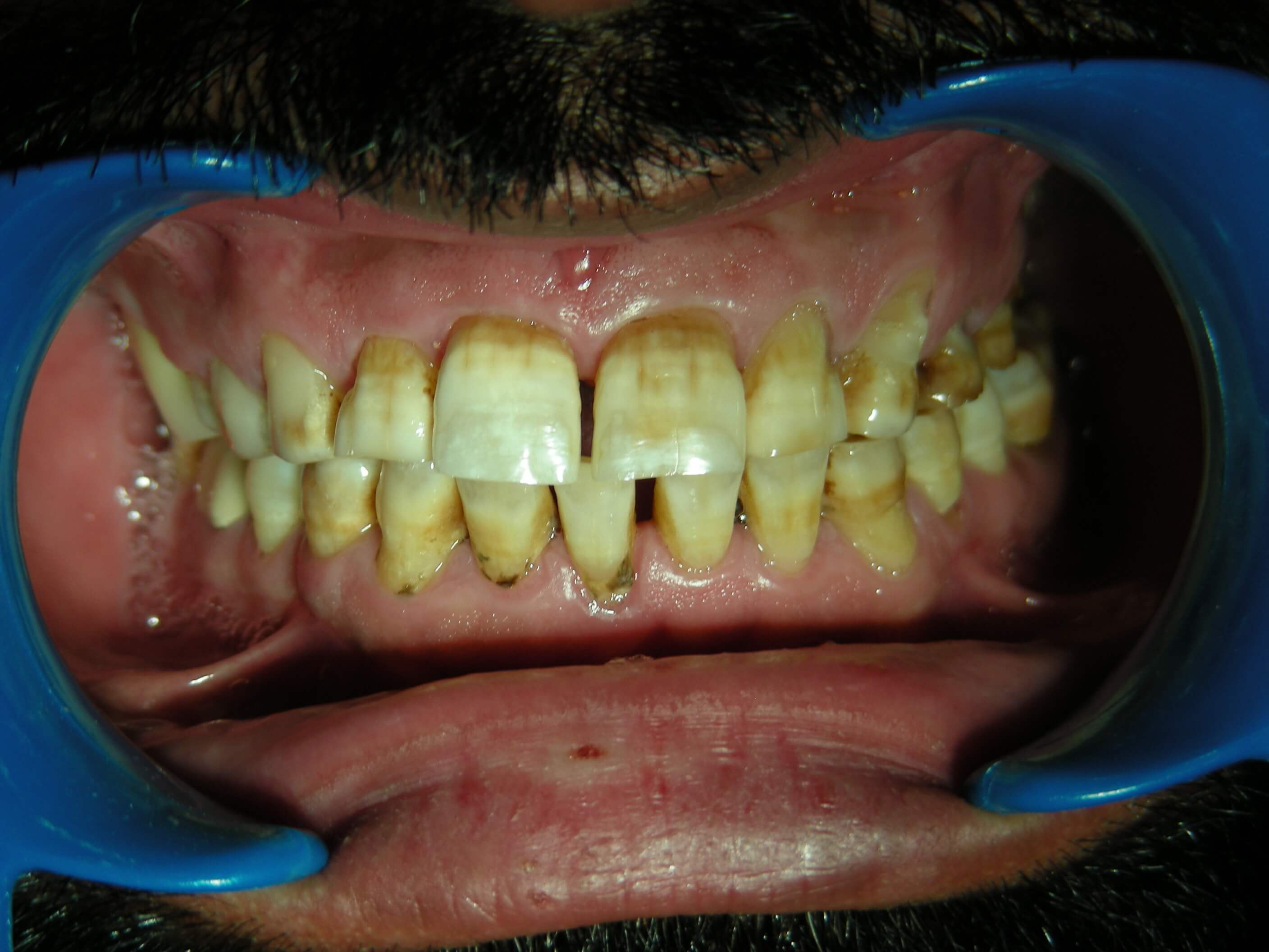 Family Dentist in Roselle