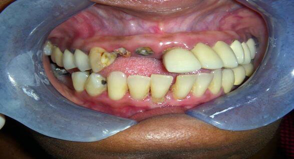 Family Dentist in Elizabeth