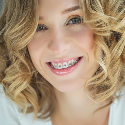 Urban Smiles Dental | Composite Veneers, Bone Grafting and Prophylaxis  Teeth Cleaning 
