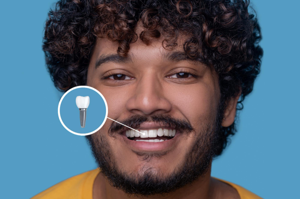 Implant Restoration in Roselle & Scotch Plains