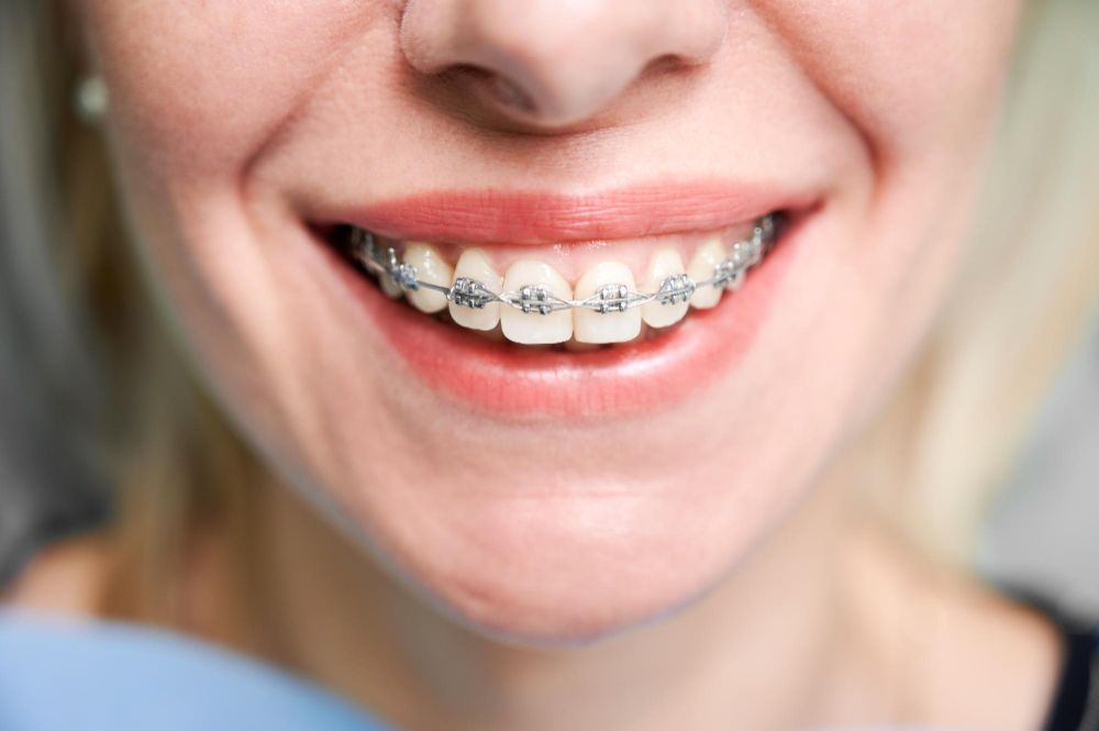 Orthodontic Services in Roselle & Scotch Plains