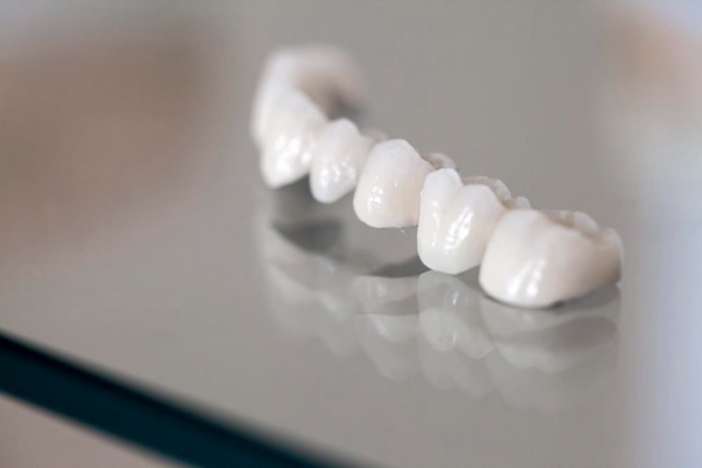 Porcelain Crowns Roselle, NJ or Scotch Plains, NJ