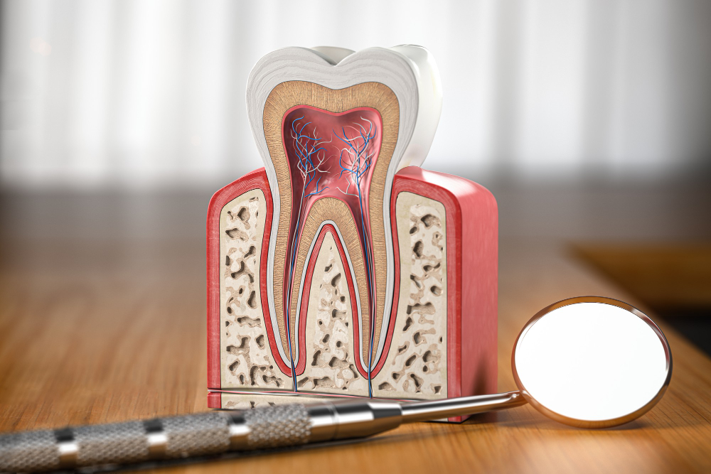 Root Canals Roselle, NJ or Scotch Plains, NJ