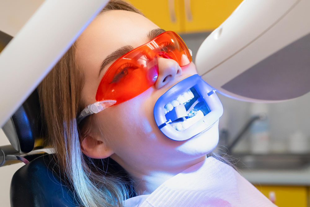Teeth Whitening  Roselle, NJ or  Scotch Plains, NJ